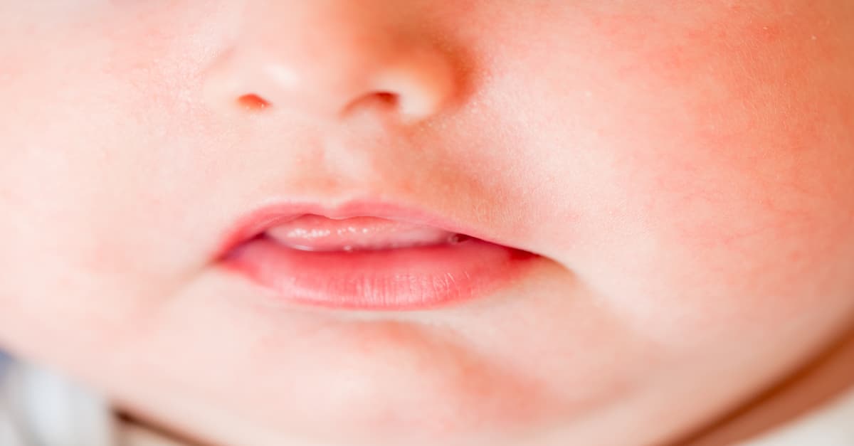 [Giải đáp từ chuyên gia] Trẻ 8 tháng chưa mọc răng có đáng lo ngại?